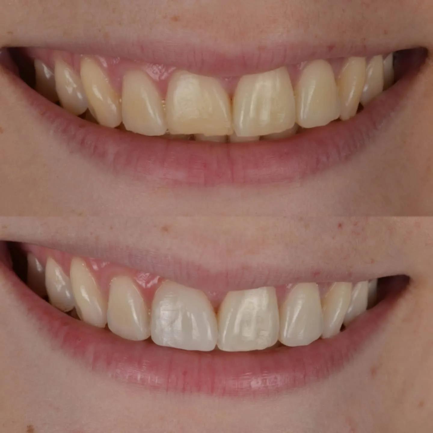 Procedimiento dental
