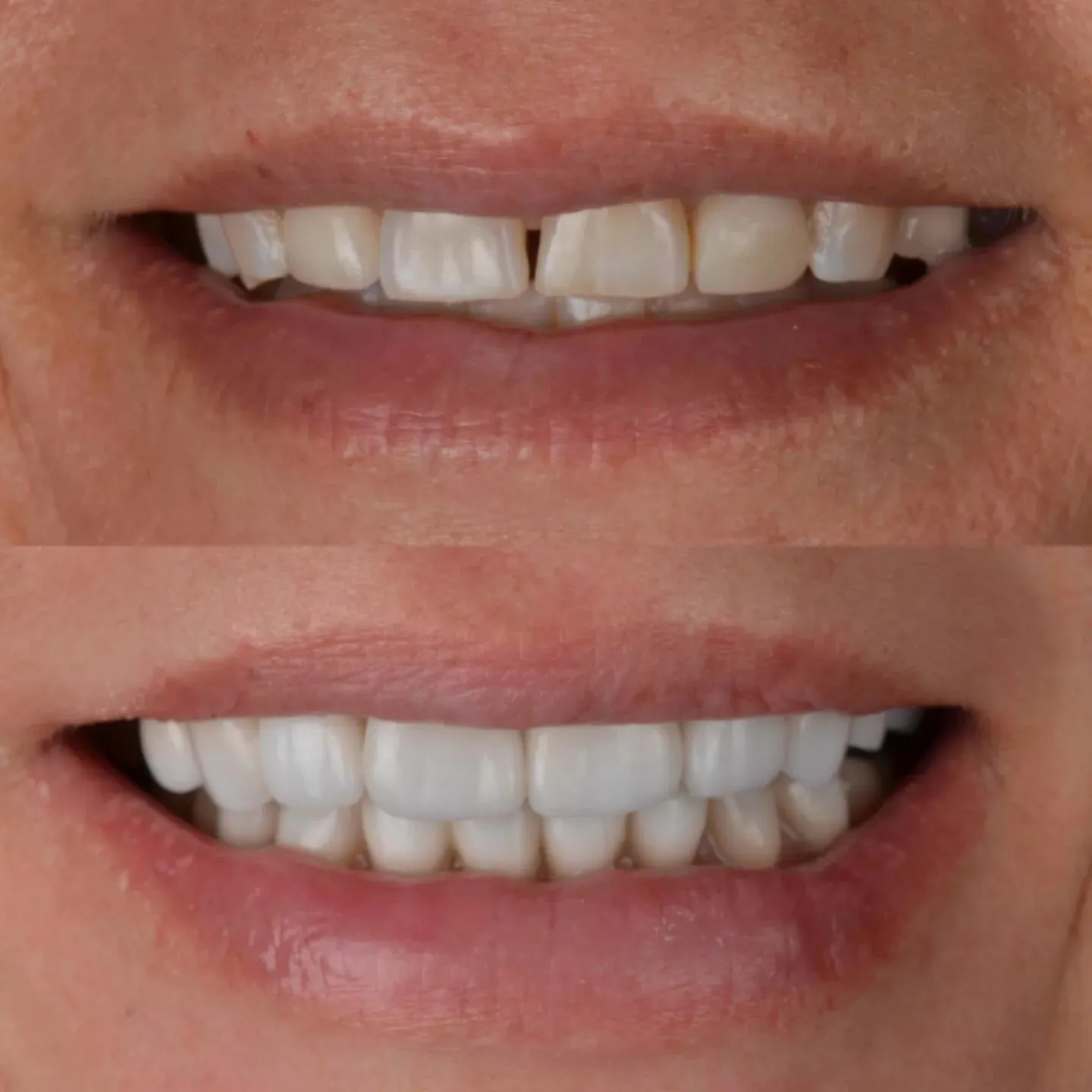 Procedimiento dental