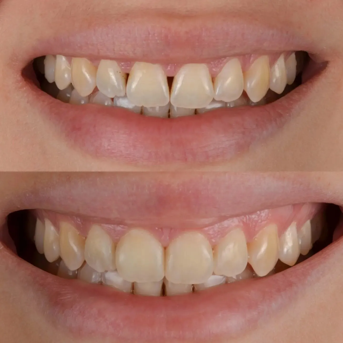 Procedimiento dental