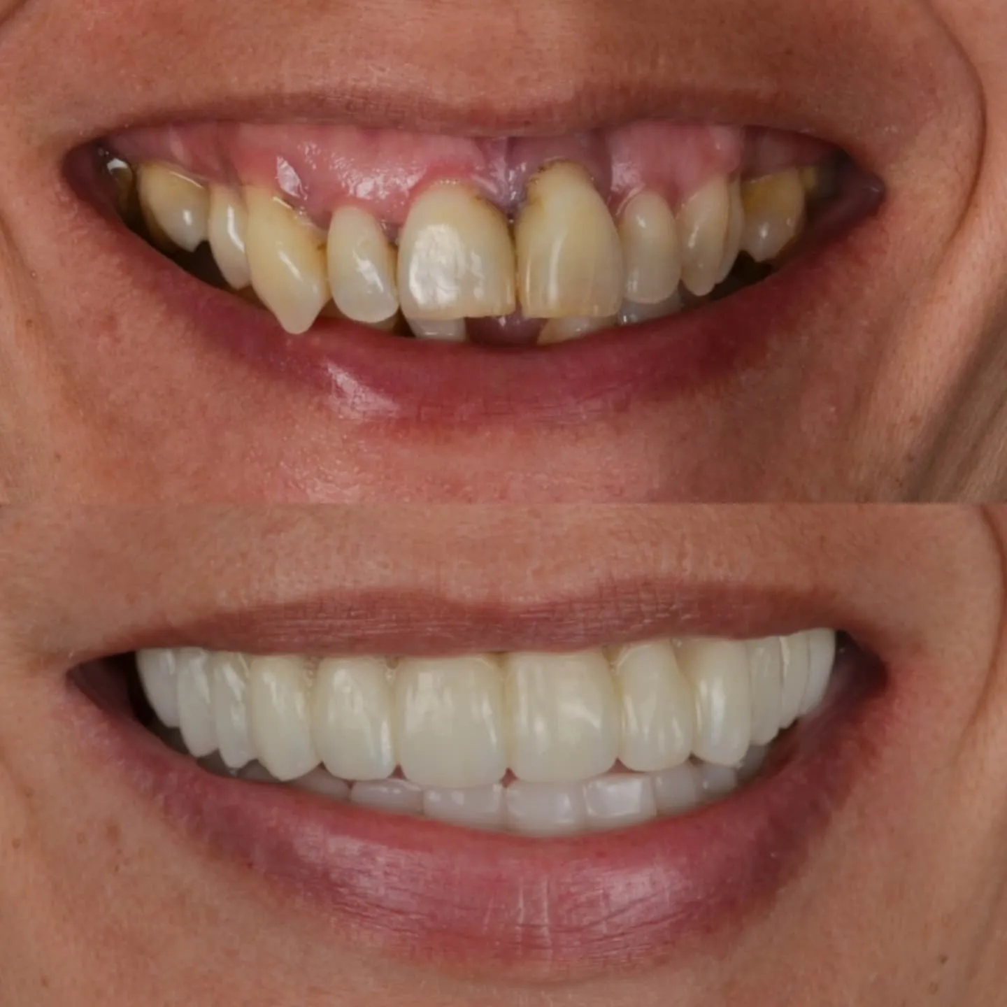 Procedimiento dental